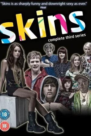 Постер к "Skins"